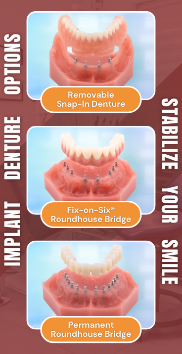 Implant Denture Options in Albuquerque, NM | Book a Free Consultation