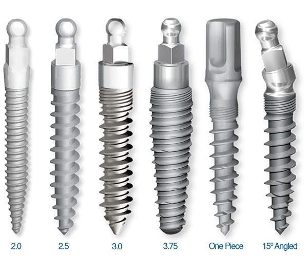 Best Implant Options in 2026 | Implant Dentist in Albuquerque, NM