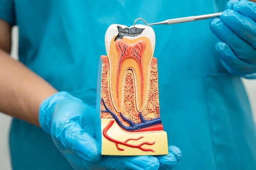 Root Canal Pain Relief in Albuquerque, NM | Free Consultations