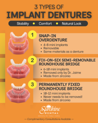 All-on-4 Alternatives in Albuquerque, NM | Implant Denture Options | Free Consultations